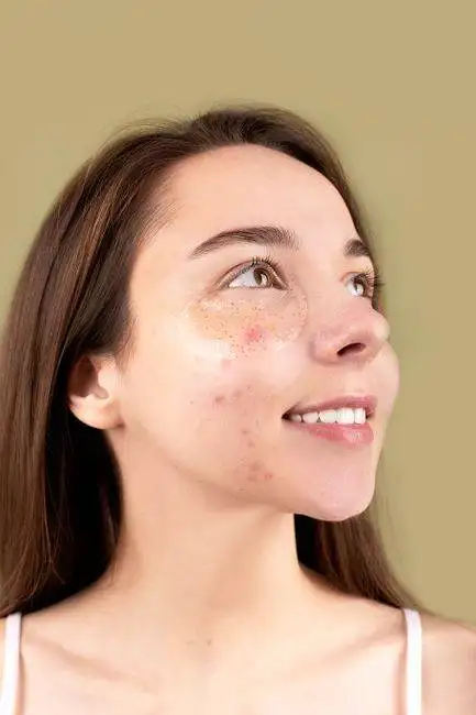 For Acne-Prone Skin: Honey Face Mask Recipes That Work