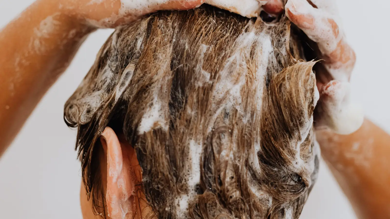 Ditch Harsh Dandruff Shampoos: Honey's Soothing Scalp Fix