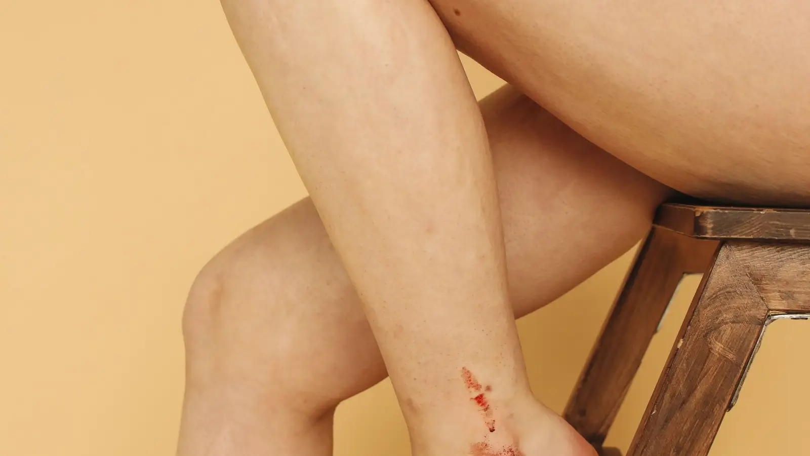 The Hydrogen Peroxide Secret Behind Honey Wound Healing